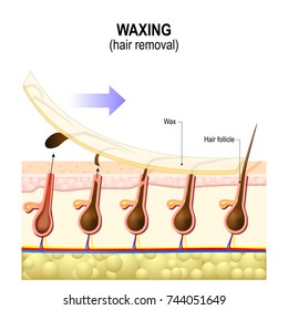 Hair removal. Waxing is a form of semi-permanent hair removal which removes the hair. Structure of the human skin