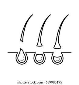 Hair removed from the skin surface without bulb, uneffective depilation. Beauty and body care concept, line art object isolated on white background. Vector illustration