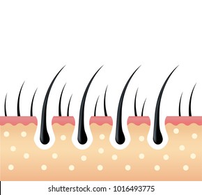 1,222 Scalp protection Images, Stock Photos & Vectors | Shutterstock