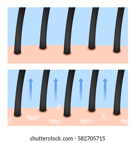 hair skin lose their moisturizer and turn to dandruff vector