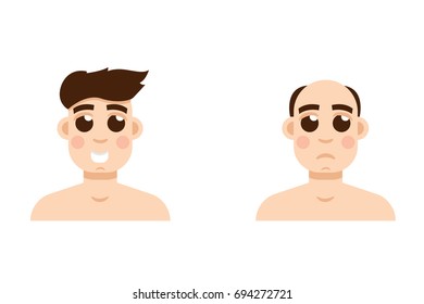 Hair stages loss. Types of baldness on male head vector.