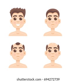 Hair stages loss. Types of baldness on male head vector.
