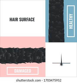 Hair Surface Of A Damaged And Healthy Hair Follicle Under The Microscope. Good And Bad Cuticle Condition Closeup. Trichology Medical Concept. Vector Illustration.