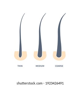 Hair thickness types classification set. Skin cross-section with fine, medium, coarse strands. Anatomical width structure scheme. Cartoon vector illustration. 