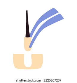 Hair transplant treatment forceps symbol. Surgical tweezers pulling out hair follicle. Alopecia medical procedure equipment tool. Hair loss diagnosis and transplantation concept. Vector illustration.