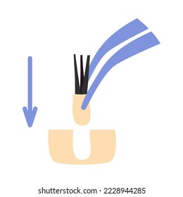 Hair transplant treatment forceps symbol. Surgical tweezers pulling out hair follicle. Alopecia medical procedure equipment tool. Hair loss diagnosis and transplantation concept. Vector illustration.