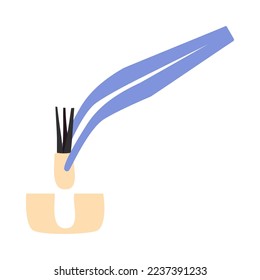 Hair transplant treatment forceps symbol. Surgical tweezers pulling out hair follicle. Alopecia medical procedure equipment tool. Hair loss diagnosis and transplantation concept. Vector illustration.