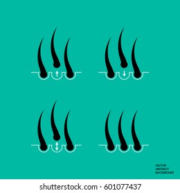 Hair transplantation. Picture of 4 processes: fallen, transplanted strengthening, healthy hair. Can be used for packaging and advertising hair care products.