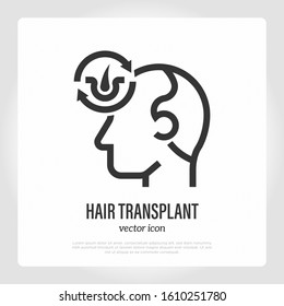 Hair transplantation thin line icon. Hair follicles in arrows. Medical procedure of extraction follicles. Vector illustration.