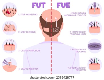 Hair transplantation, vector illustration on white background. Fut vs fue poster with information elements, follicular unit extraction. Baldness problem, surgical treatment. Medical infographic.