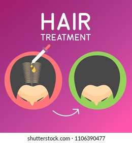 Hair Treatment Illustration