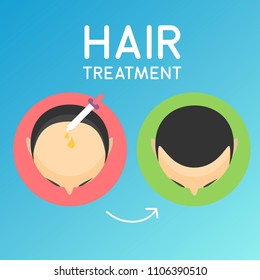 Hair Treatment Illustration