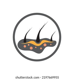 Hair treatment logo hair transplantation logo,removal logo vector image design illustration

