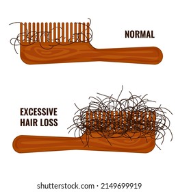 Hairbrush with hair stuck in the teeth. Hair strands on a comb. Excessive hair fall problem. Alopecia symptom concept. Vector illustration.