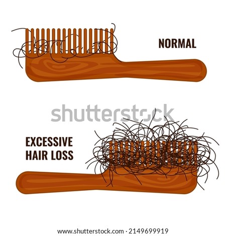 Hairbrush with hair stuck in the teeth. Hair strands on a comb. Excessive hair fall problem. Alopecia symptom concept. Vector illustration. ストックフォト © 