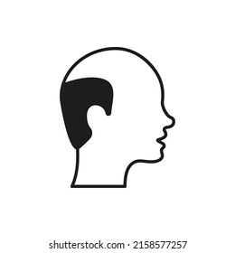 Hairless Male Black Icon. Bald Man Silhouette Pictogram. Hair Loss, Alopecia Medical Problem Icon. Isolated Vector Illustration.