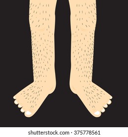 Hairy legs.Vector Illustration.