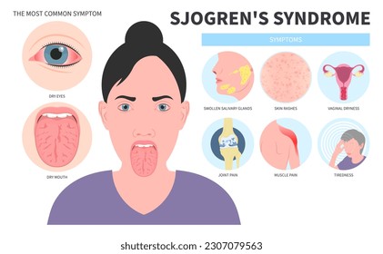 Halitosis Syndrome dry eye and Lymph nodes redness saliva with sialadenitis Intraoral of Sjogren's Burning Fissured the throat skin Cracked sore tongue Difficulty swallowing