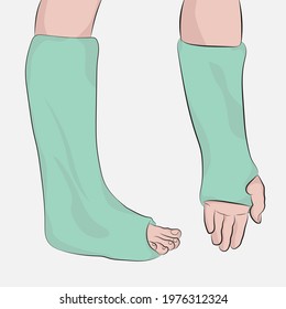 Hand and arm in a cast, bandage on limbs.