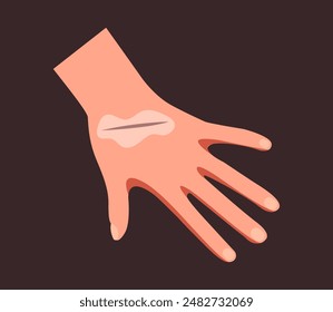 Brazo de mano con concepto de herida. Ilustración de Diseño gráfico plano de Vector
