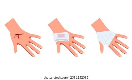 Brazo de mano con el concepto de pasos de tratamiento de heridas. Ilustración de diseño gráfico plano vectorial