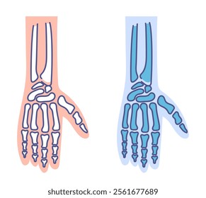 Hand arm x ray radiography medicine concept. Vector flat graphic design cartoon illustration