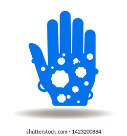 Hand blebs and blisters icon vector. Eczema or dermatology psoriasis logo. Skin dermatitis disease illustration. Epidermis infection sign.