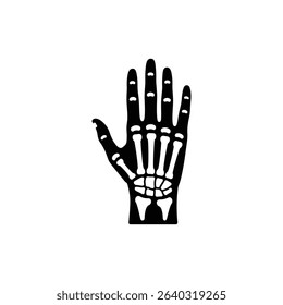 Hand Bones Open Palm View Human Anatomy Medical Image