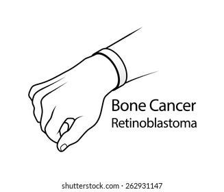 A hand with a cause bracelet. White, Bone Cancer, Retinoblastoma. 