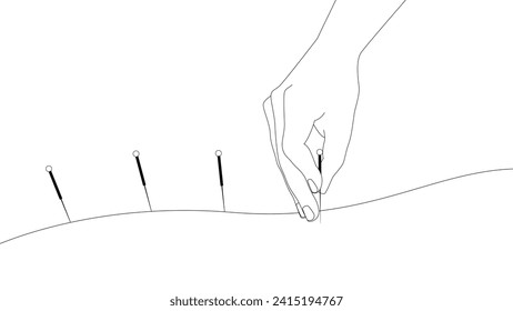 Hand of doctor performing acupuncture therapy. Alternative medicine concept, vector illustration, clip art in black and white outline.