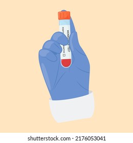 The hand of a doctor in a protective glove holds a test tube. Monkeypox virus test. Positive or negative test. Test systems.
