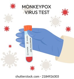 The hand of a doctor in a protective glove holds a test tube. Monkeypox virus test. Positive or negative test. Test systems.