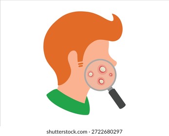 Pústula de acne desenhada à mão na pele da cara Clip-art