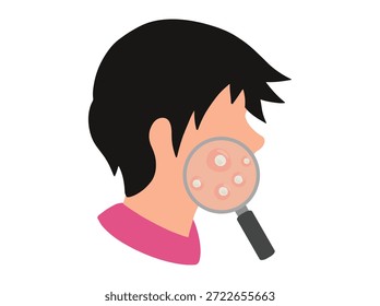 Mão desenhado Acne Whitehead no rosto Skin Clip Art