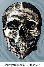 Hand Drawn Deformed Skull With Cleft Chin, Colored Vector Illustration. Isolated On Blue Background With Flow Lines.