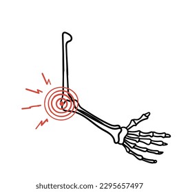 handgezeichnete Knochenschmerzgrafik