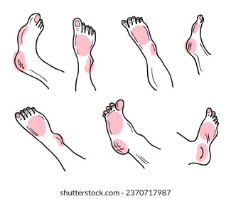 Hand drawn feet and legs body parts collection. Health care, cosmetic and therapy concept. Isolated vector illustration.


