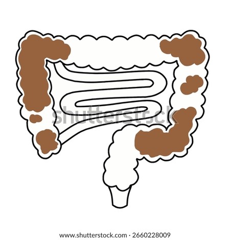 Hand drawn Intestines showing constipation with dry and hard stool vector illustration. Medical illustration