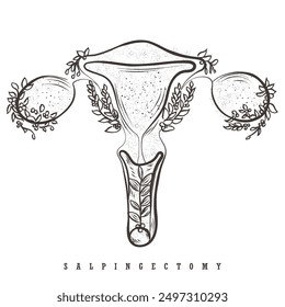 hand drawn line art vector of a uterus surrounded by flowers and with fallopian tubes removed. Salpingectomy concept.