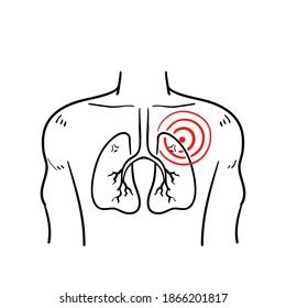 hand drawn pneumonia icon, asthma or tuberculosis, line symbol on white background. in doodle style vector isolated
