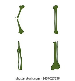 Hand drawn realistic human bones. Vector illustration