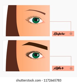 Hand drawn vector illustration of eyelash extensions. Flat illustration of eyelash extension: before and after.