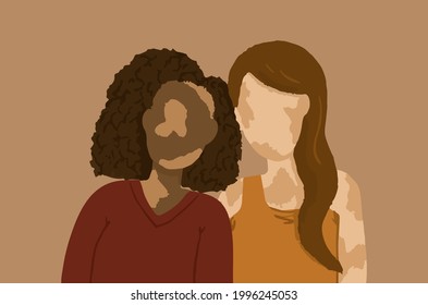 Hand drawn vector illustration of two adult women with vitiligo.