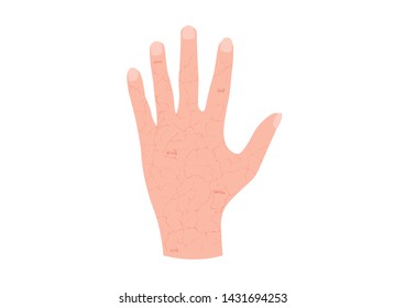 hand and dry skin vector / aging