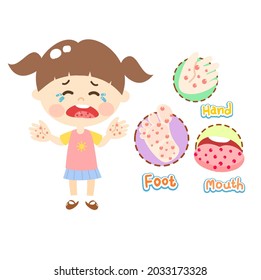 Hand Foot and Mouth Disease. 		