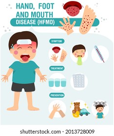 Hand, foot and mouth disease (HFMD) with symptoms prevention and treatment Infographics. Children infected vector illustration.