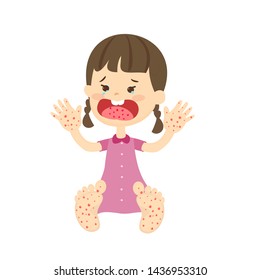 Hand Foot and Mouth  Disease Thomson Medical 