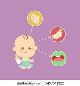 Hand Foot and Mouth Disease Vector