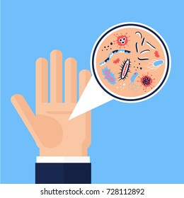 Hand germs magnification concept. Stock vector illustration for hand hygiene, public health, risk of spreading illness by dirty infected palm with microscopic viruses and bacteria. Flat style