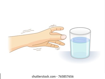 A Hand Have Tremor Symptom Reaching Out For A Glass Of Water. Illustration About Loss Of Control Of Balance And Body And Health Problem.